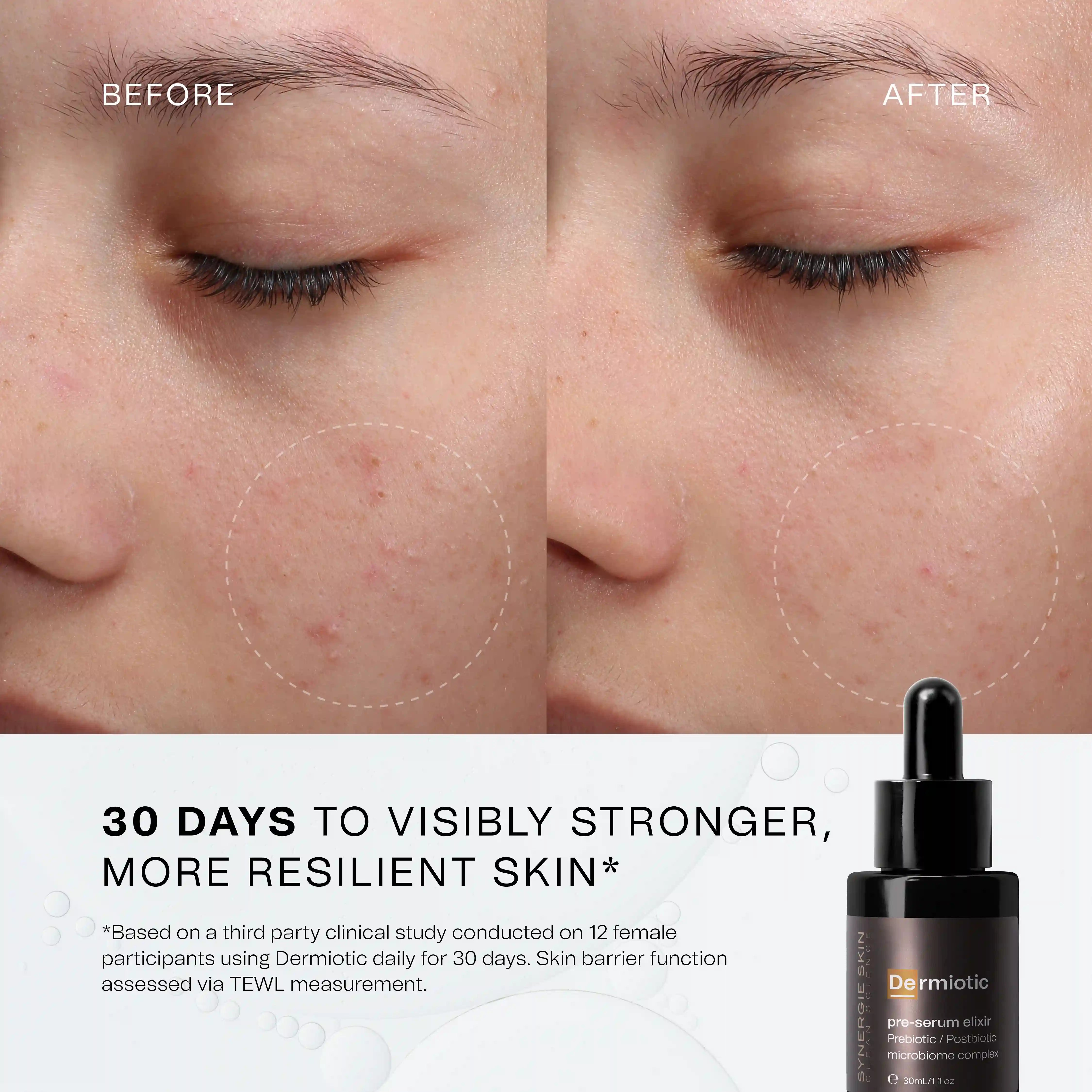30 days to visibly stronger more resilient skin*