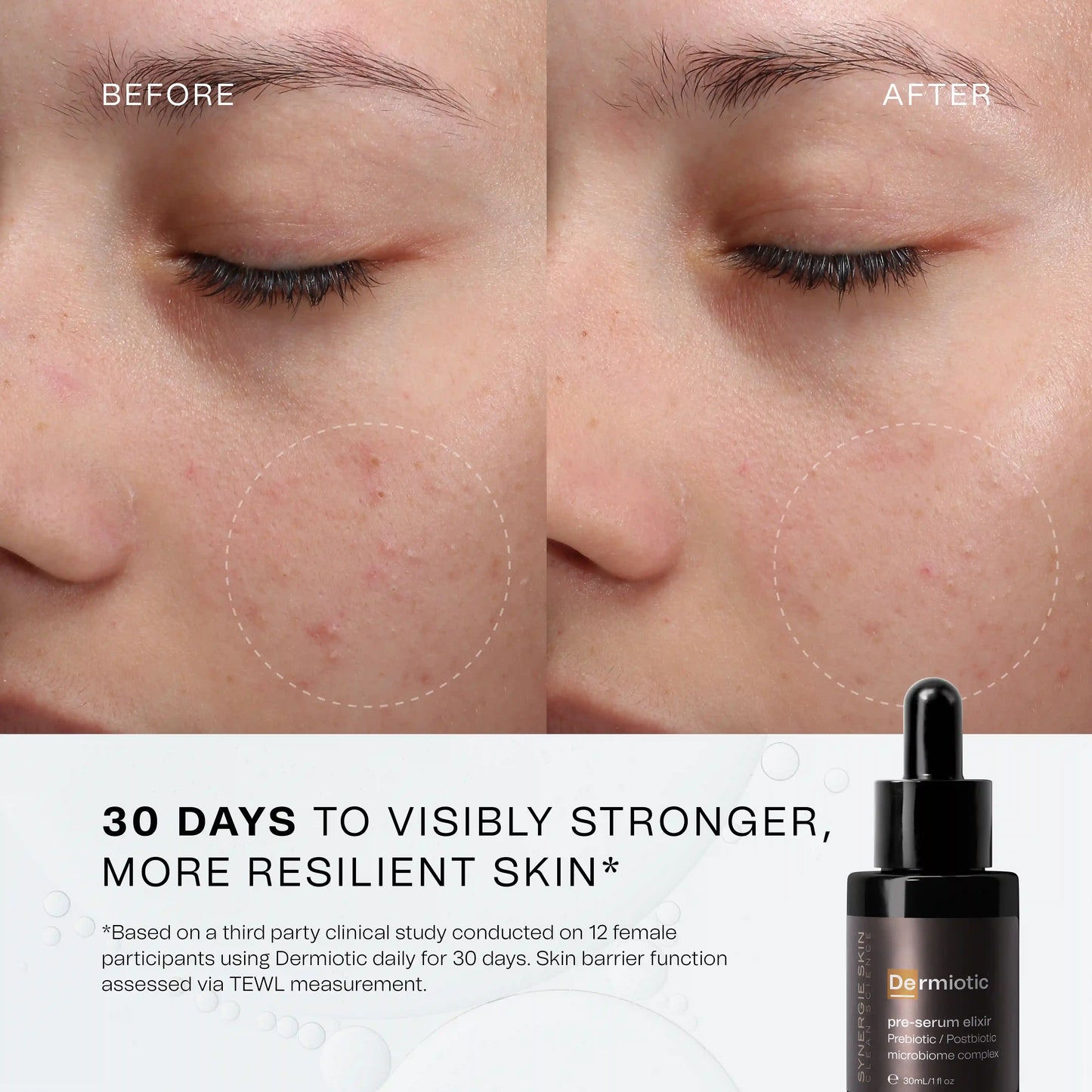 30 days to visibly stronger more resilient skin*