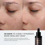 30 days to visibly stronger more resilient skin*