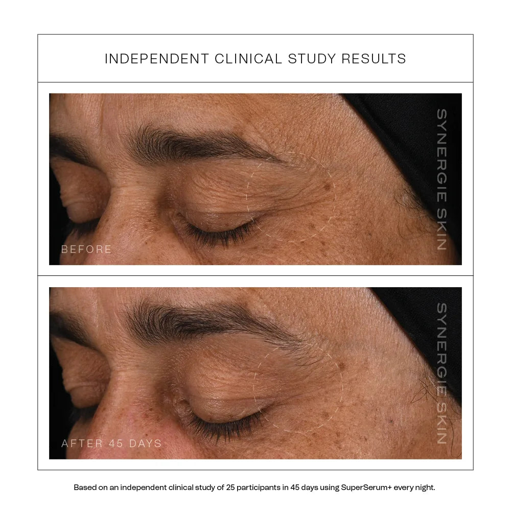 Independent clinical study results