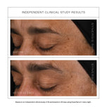 Independent clinical study results