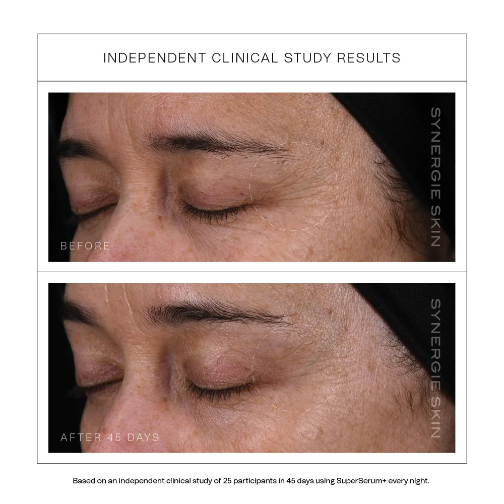 Independent clinical study results