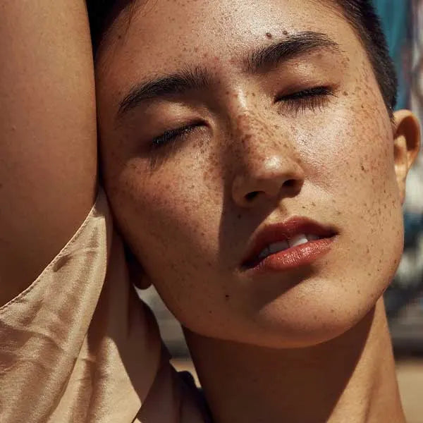 Woman with freckles in sunlight