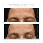 Acceler-A by Synergie Skin clinical study results