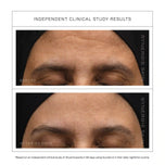 Acceler-A by Synergie Skin clinical study results