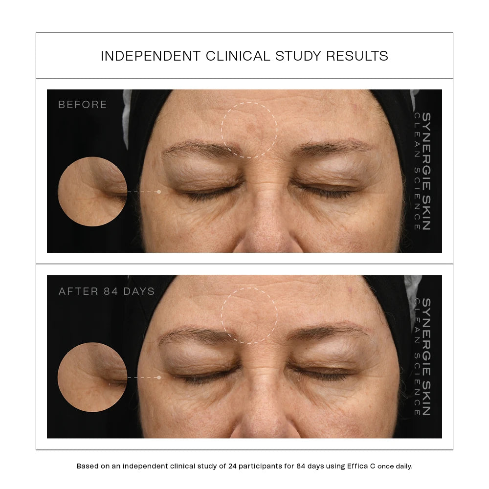 EfficaC Clinical Data reults_Before and after